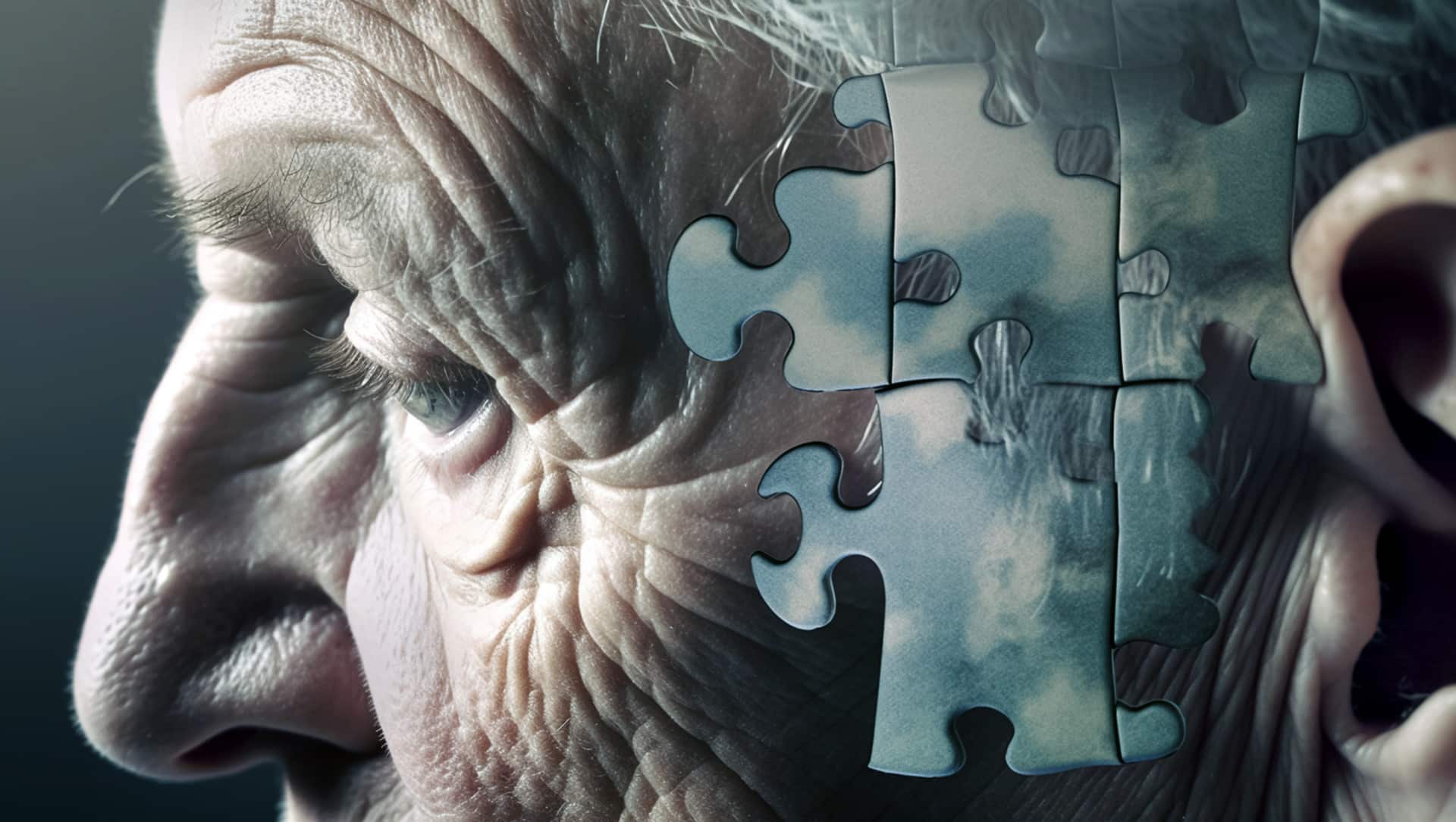 Alzheimers disease and other forms of dementia